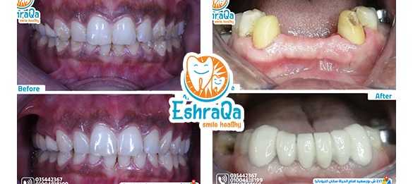 a1245b33-fbce-4dfe-8a14-c72f3bd96a00.jpg